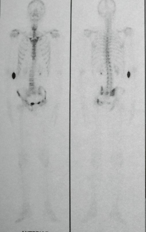 Figura 101: Cintilografia vista de frente e posterior.