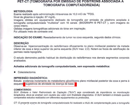 Figura 76: Laudo do Pet-Cet, com uma interpretação equivocada, sugerindo "atividade da doença de base". Na realidade trata-se da expressão inflamatória residual da radioterapia, SUV 2.0, baixo. Os "focos de calcificação" nada mais são do que os clips de demarcação do leito operatório, para orientação da radioterapia.