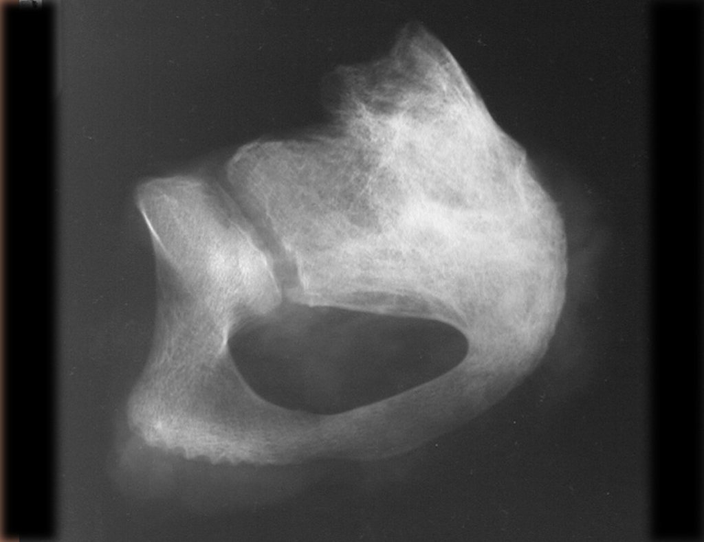 Figura 28: Radiografia da peça, vista do anel obturador e parte da cartilagem em Y.