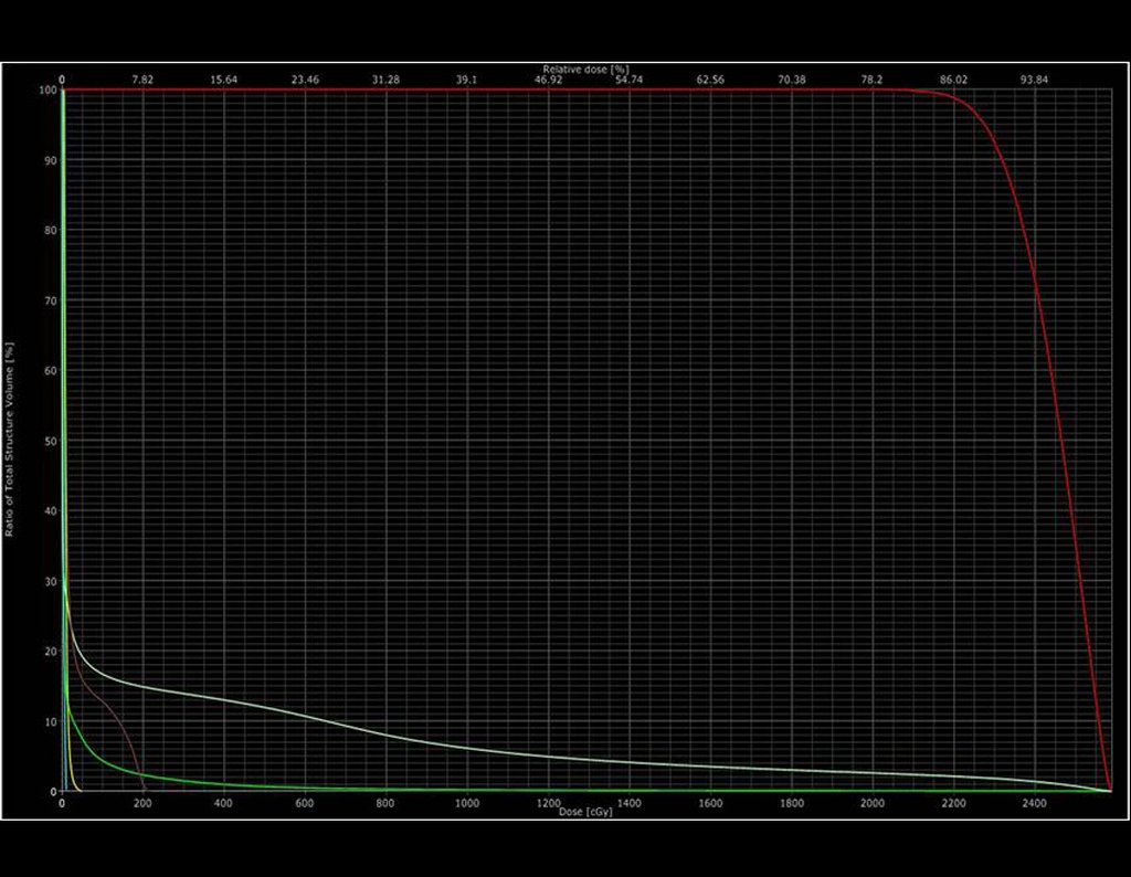 Figura 26h: Histograma de dose-volume: vermelho representado dose no tumor e tons de verde, marrom e amarelo órgãos de riscos, com doses absolutamente menores.