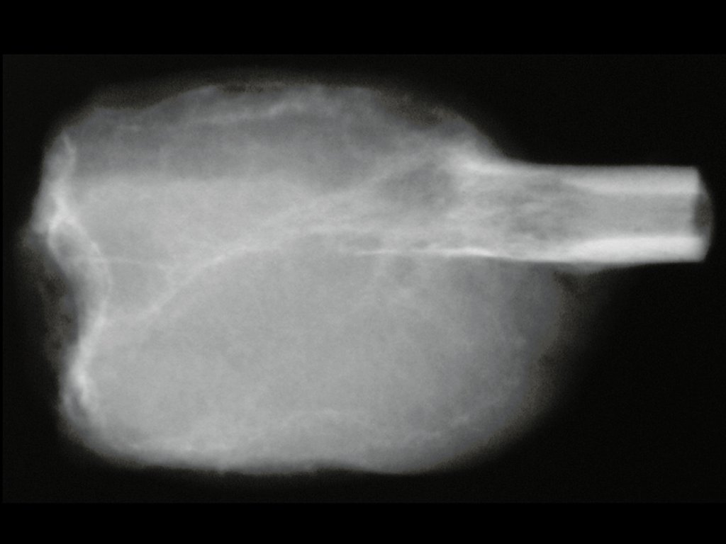 Figura 94: Radiografia perfil, da peça cirúrgica.