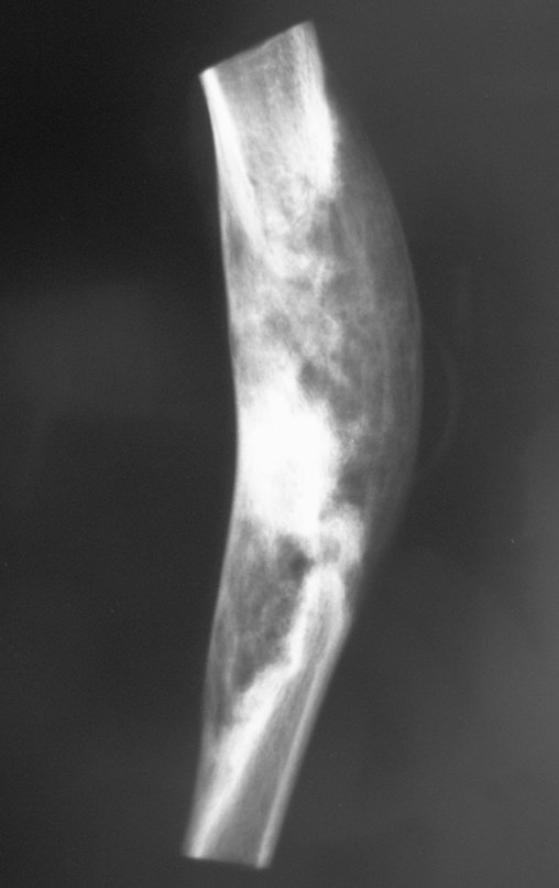 Figura 88: Radiografia da peça cirúrgica.