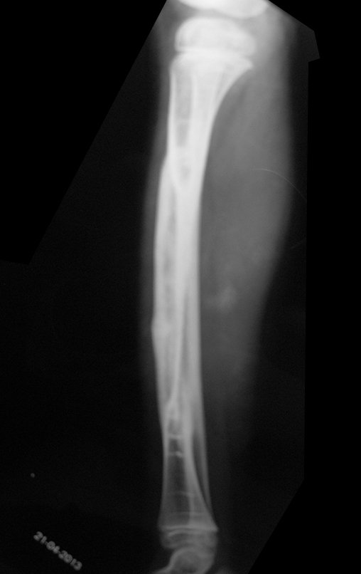 Figura 129: Radiografia em perfil, 20/04/2013.