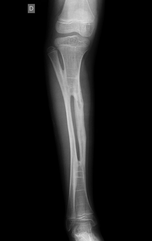 Figura 153: Radiografia em perfil, em 10/11/2015.