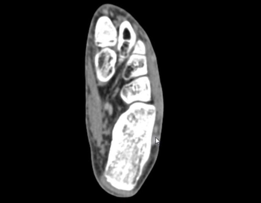 Figura 11: TC, densidade para tecidos moles.