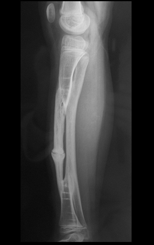 Figura 133: Radiografia em perfil de 22/07/2013, calo hipertrófico.