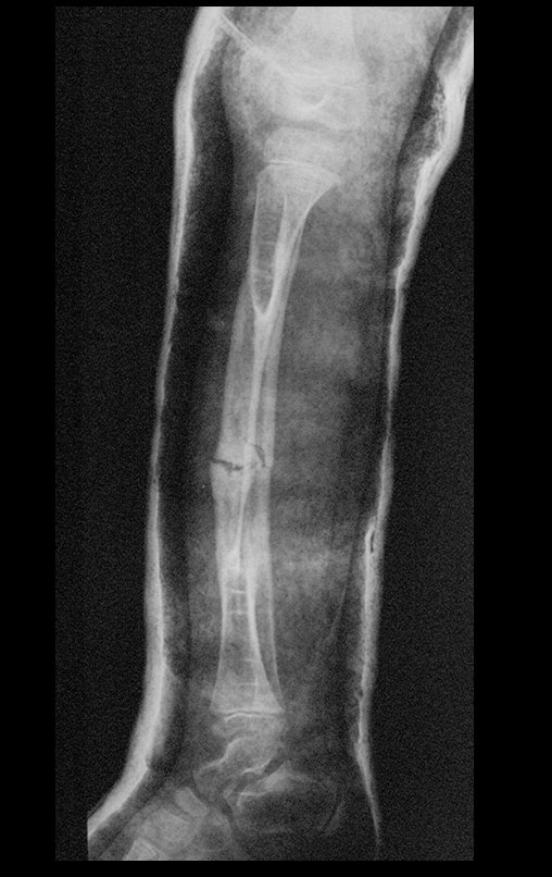 Figura 141: Radiografia de controle, perfil, em 14/10/2013.