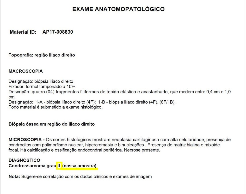 Figura 102: Estudo da amostra colhida pelo patologista, na sala de radiologia, conhecida como biópsia de congelação.