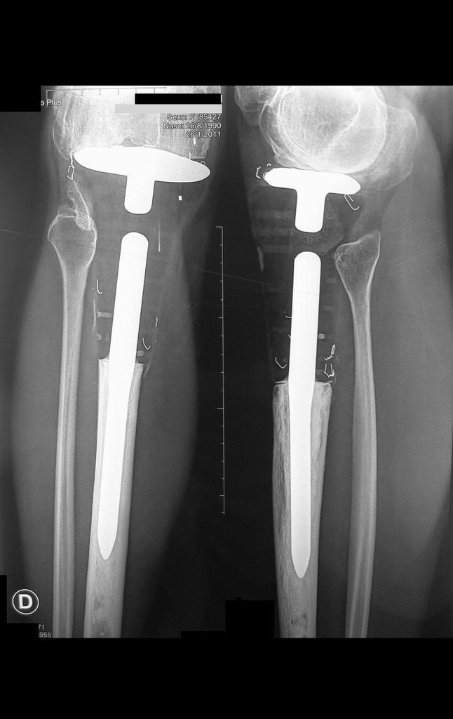 Figura 142: Radiografias Frente e perfil, após cinco anos e seis meses.