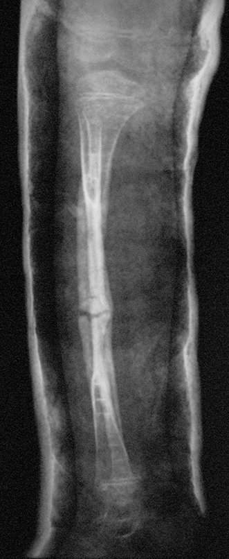 Figura 145: Radiografia de controle após oito semanas, perfil, em 06/12/2013.