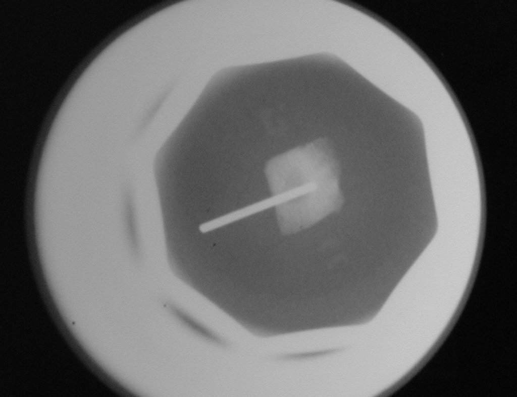 Figura 34: Radiografia para avaliação da resseção completa do nicho. Agulha está no centro do "nidus", área de rarefação circundada por esclerose óssea.