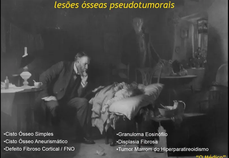 Lesões Ósseas Pseudotumorais