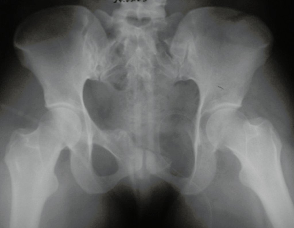 Figura 78: Radiografia do pós operatório imediato.