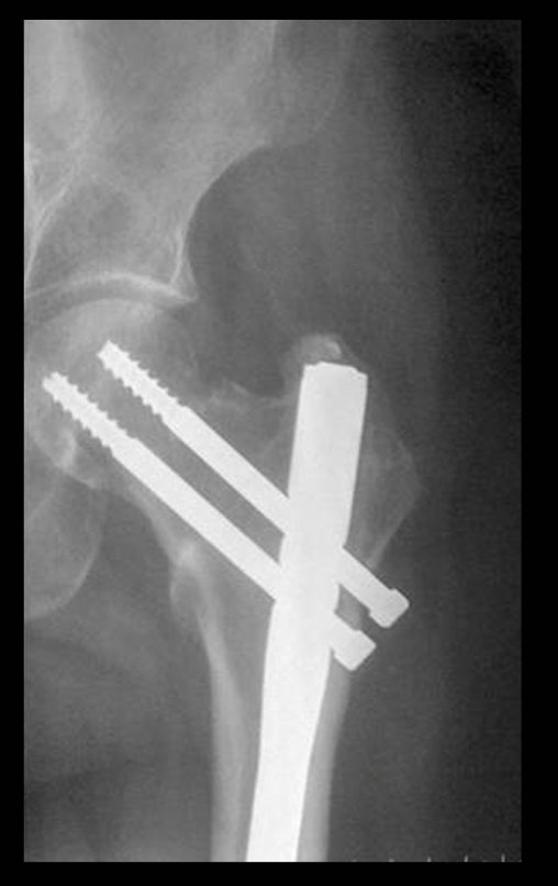 Figura 9: Radiografia do quadril frente.