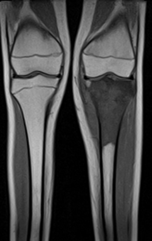 Figura 35: RM cor T1.