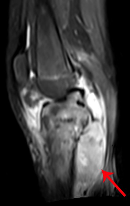 Figura 19: RM sag-stir-fil.